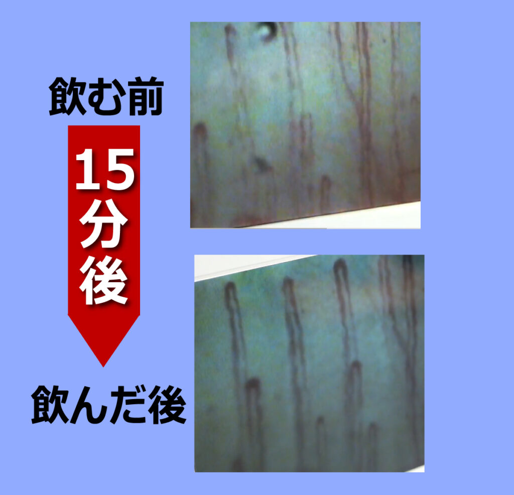 スーパーSP100 血管の中 特許 高血圧 血液サラサラ