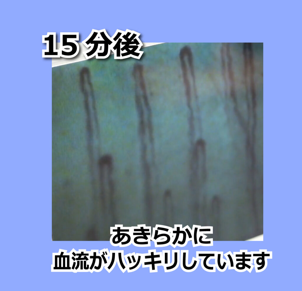 スーパーSP100 血管の中 特許 高血圧 血液サラサラ